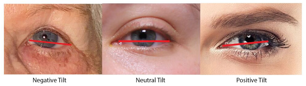 What is a canthal tilt?